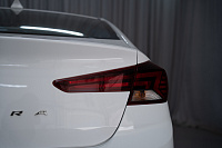 Hyundai Elantra- Миниатюра фото 6